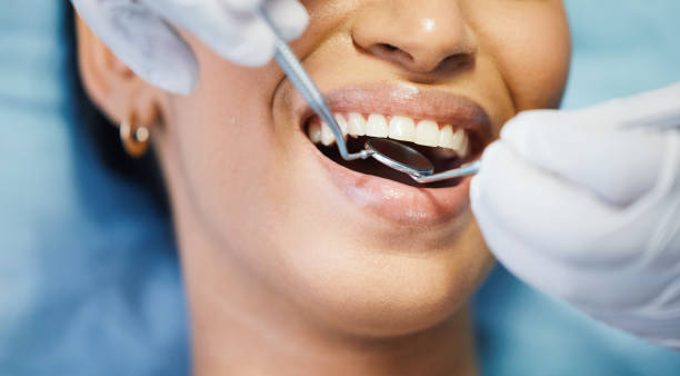 Best Urgent Tooth Repair  in Forest City, FL