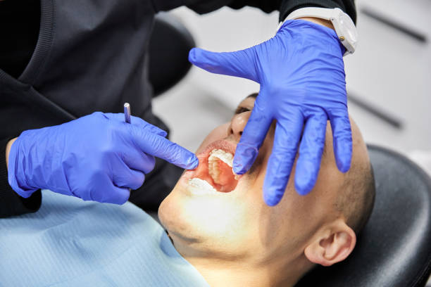 Best Teeth Whitening  in Forest City, FL