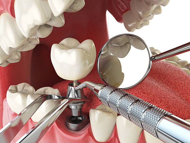 Best Emergency Gum Pain Relief  in Forest City, FL